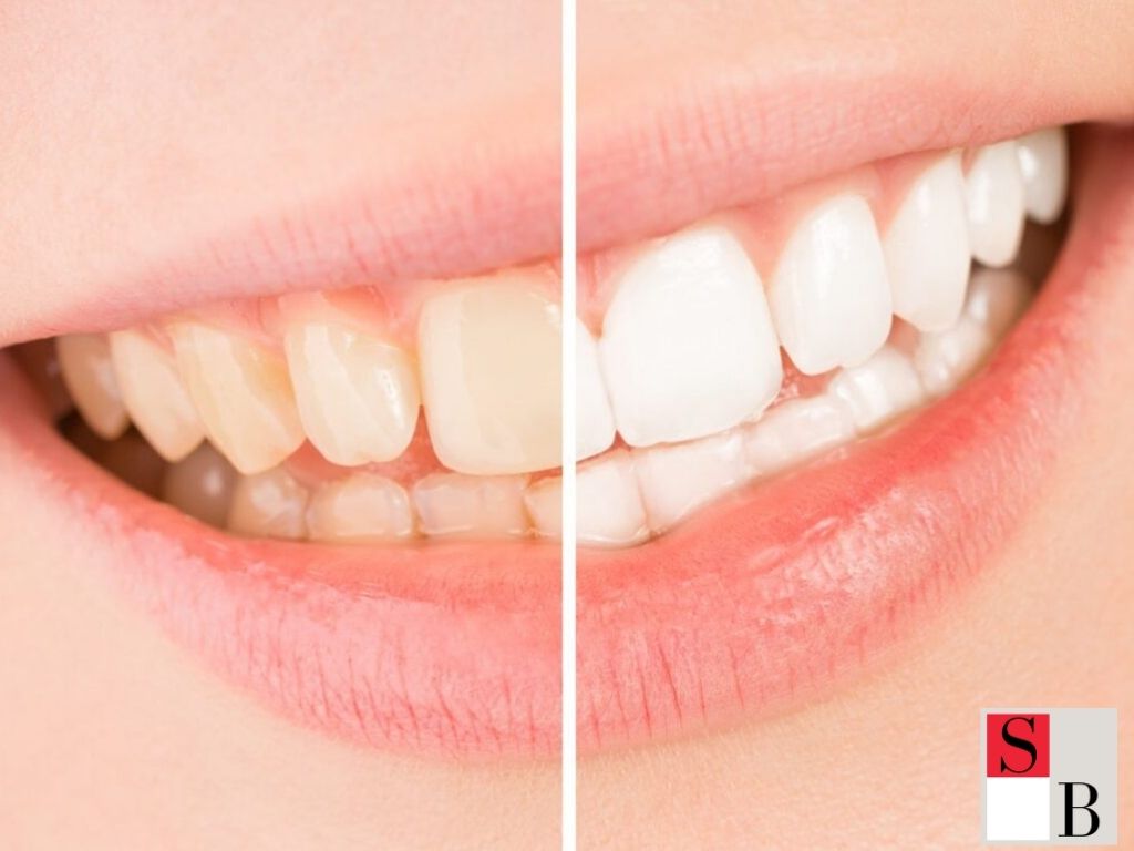Effective Teeth Whitening Tips for Coffee Drinkers