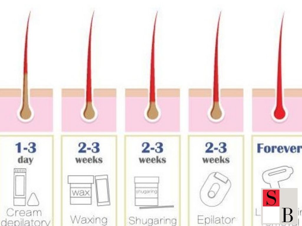 Practical Hair Removal Options for Singaporean Men