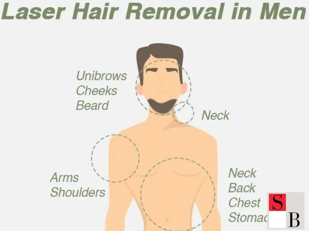 Understanding Male Hair Removal in Singapore