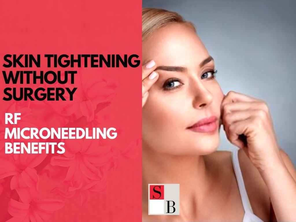 Skin Tightening Without Surgery: RF Microneedling Benefits