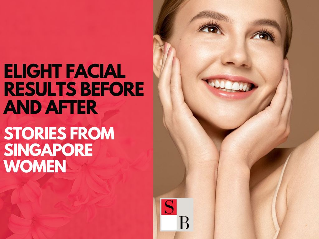 Elight Facial Results: Before and After Stories from Singapore Women