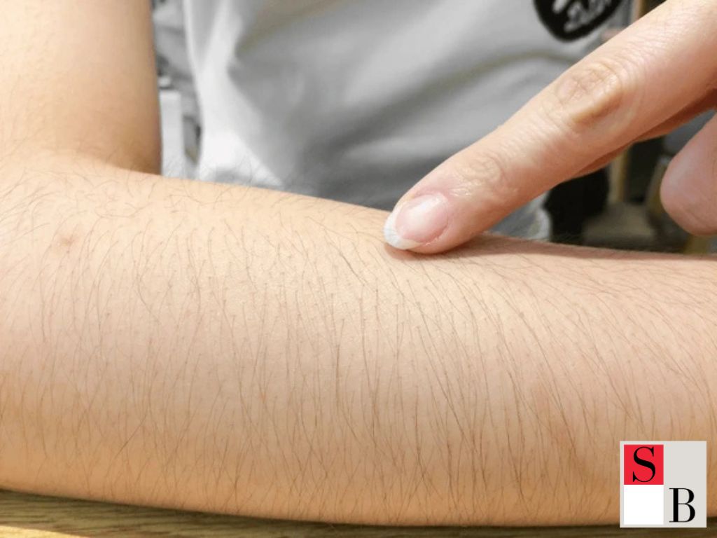 How to Choose the Best Hair Removal Method for Your Skin in Singapore
