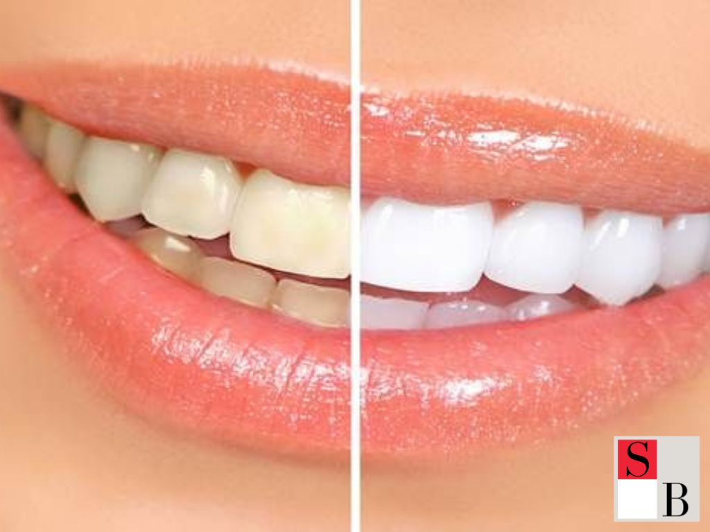 How to Apply Natural Whitening Methods Safely in Singapore
