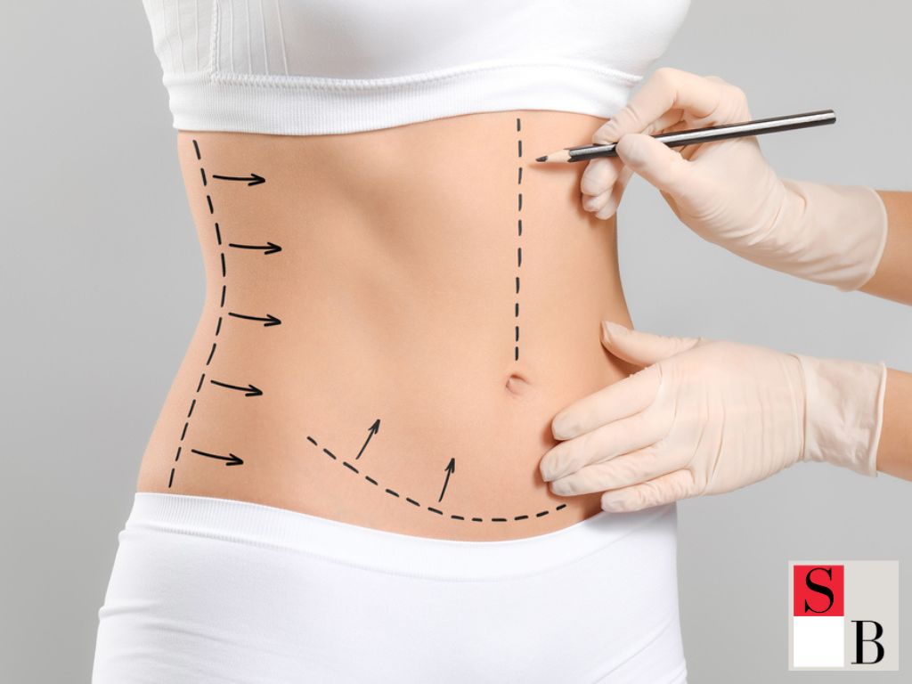 What Is Convenient Body Sculpting in Singapore?