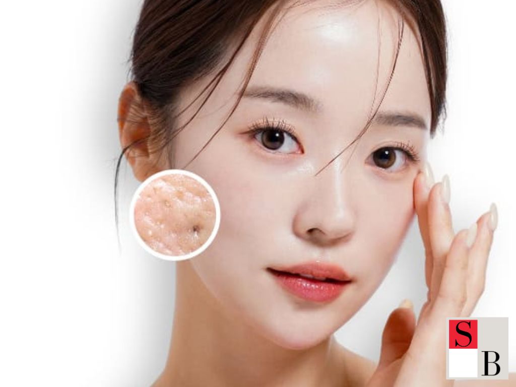Key Benefits of Professional Facial Treatments in Singapore