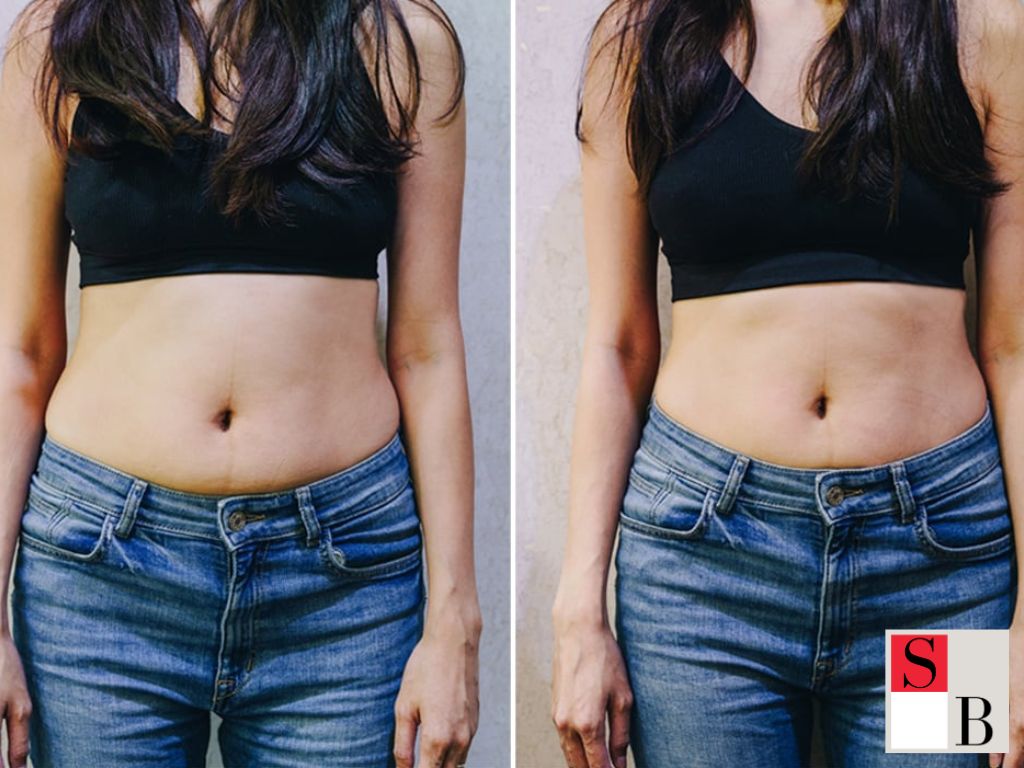 Why Busy Professionals Choose Body Sculpting in SingaporeWhy Busy Professionals Choose Body Sculpting in Singapore