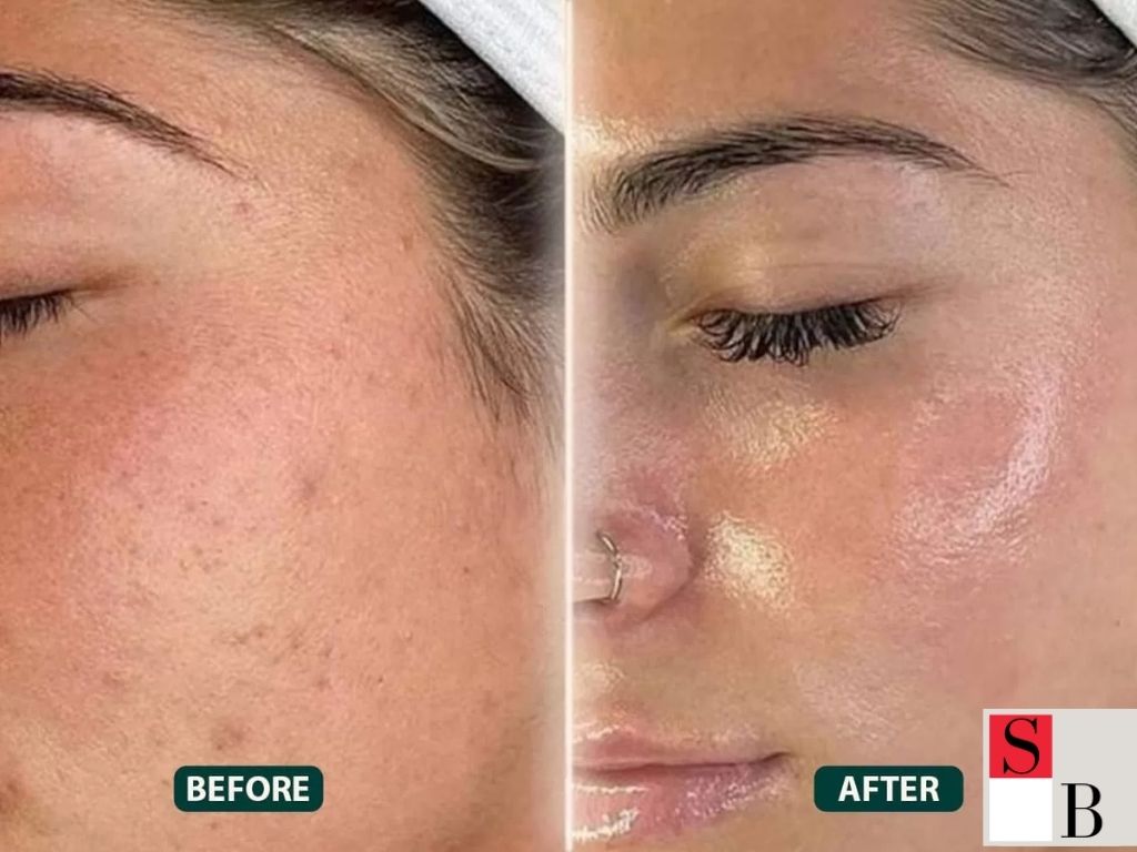 How to Achieve Quick Skin Transformation in Singapore