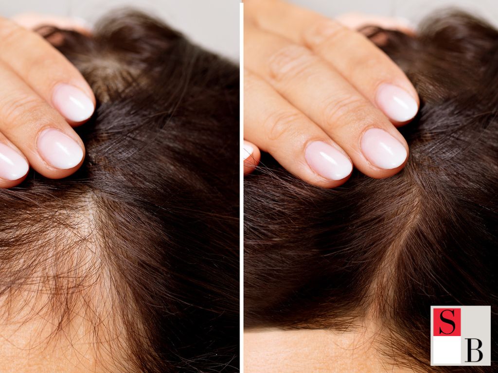 Understanding Urban Hair Stress: Why Singaporeans Need Regular Hair Treatments