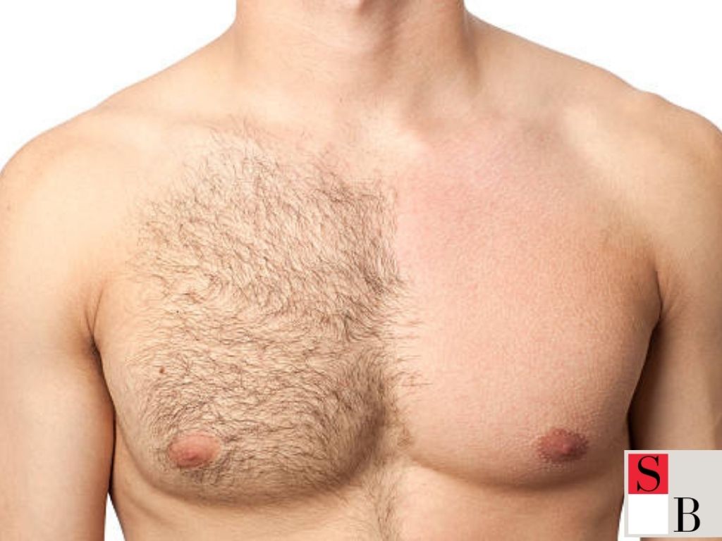 Understanding Hair Removal for Singapore Men