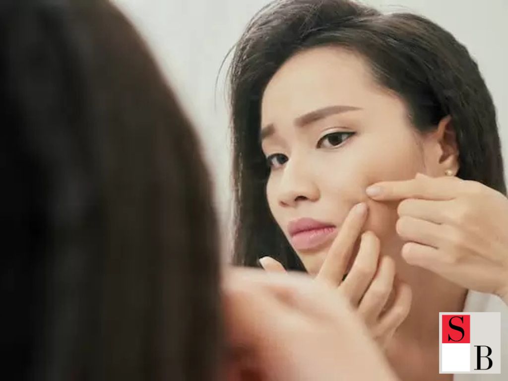 How to Prevent Skin Breakouts Before Chinese New Year
