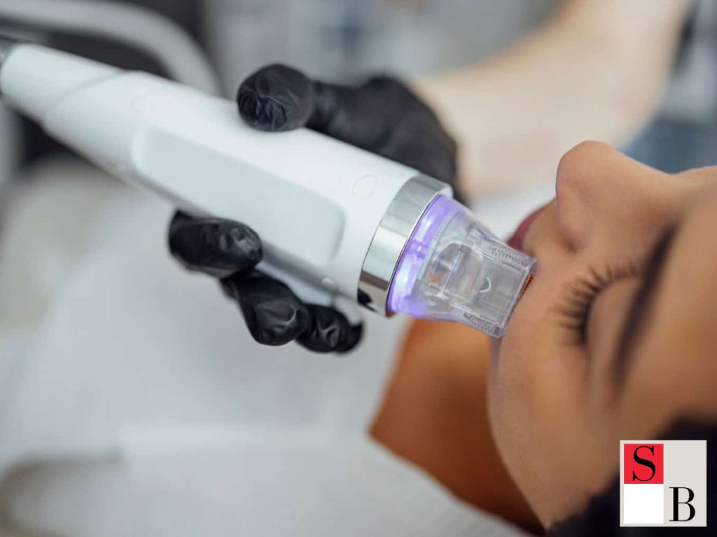 How to Maximize RF Microneedling Results in Singapore’s Climate