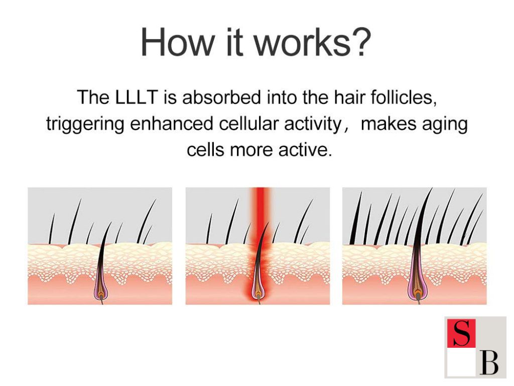 Understanding Hair Growth Treatments in Singapore