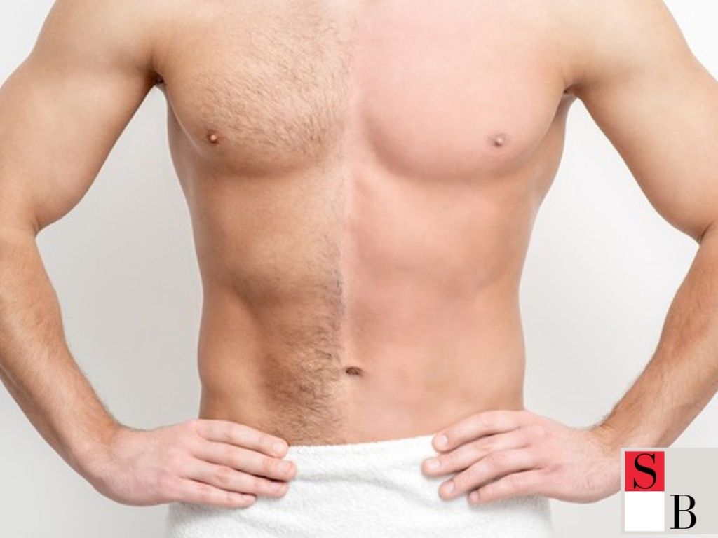 How to Choose the Right Hair Removal Method in Singapore
