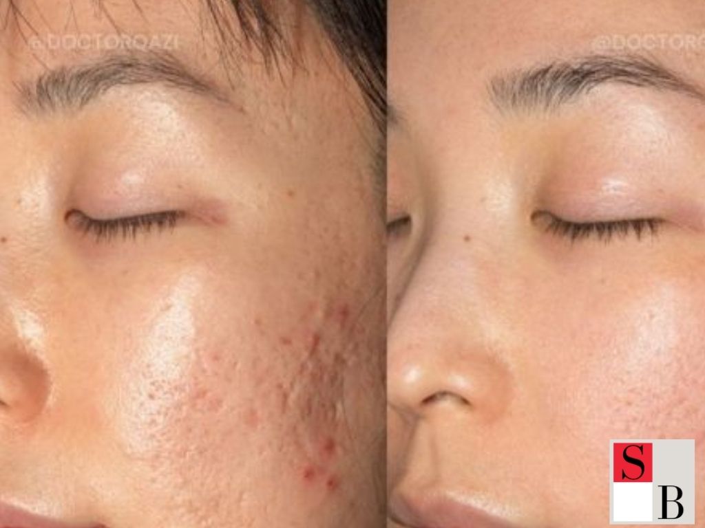 How to Choose and Implement Facials at Clinics Near Orchard Central Singapore