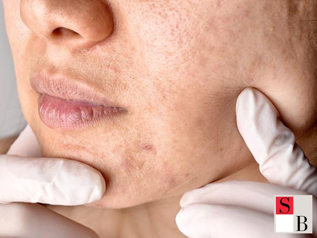 Understanding Facials in Singapore’s Humid Climate