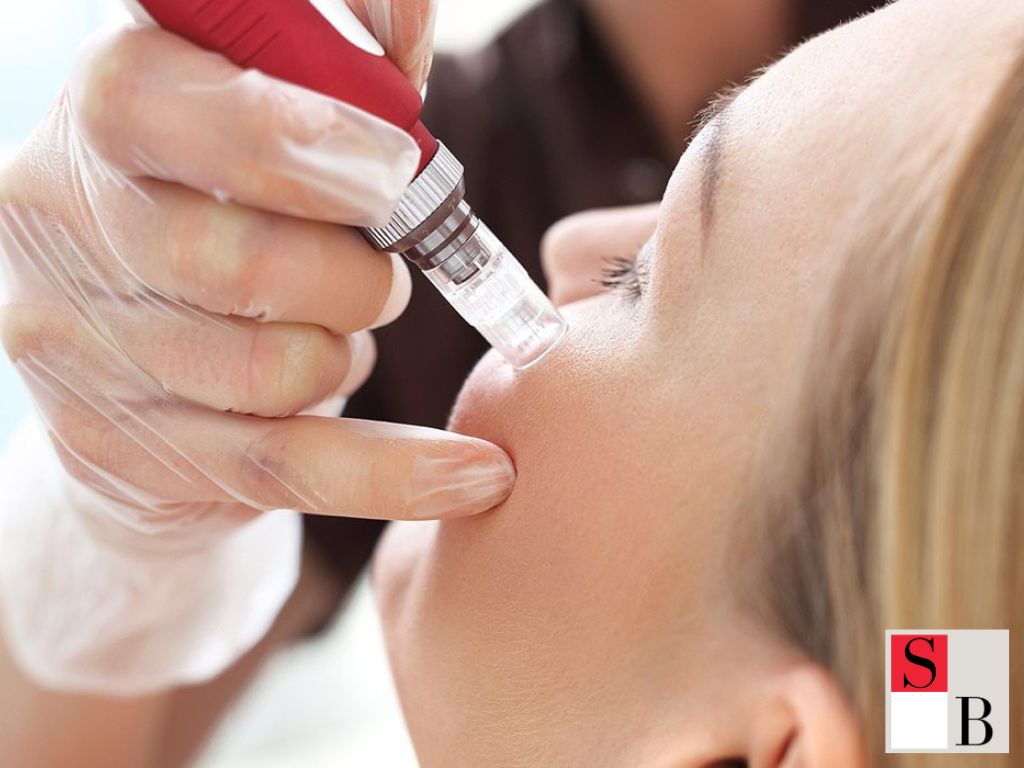 How to Get the Best Results from Your Microneedling Treatment in Singapore