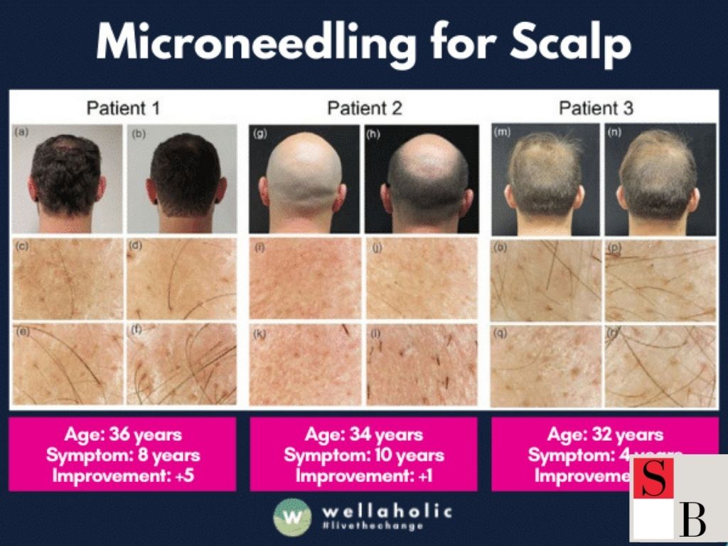 What Makes Asian Hair Unique in Singapore’s Climate