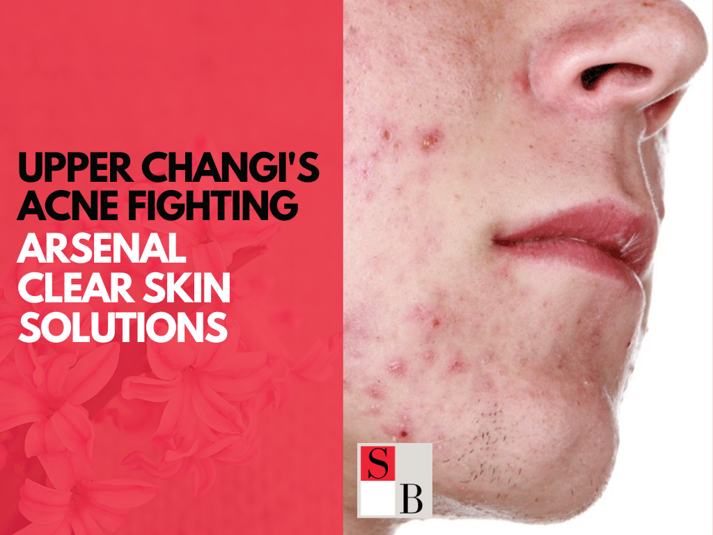 Upper Changi’s Acne Fighting Arsenal Clear Skin Solutions