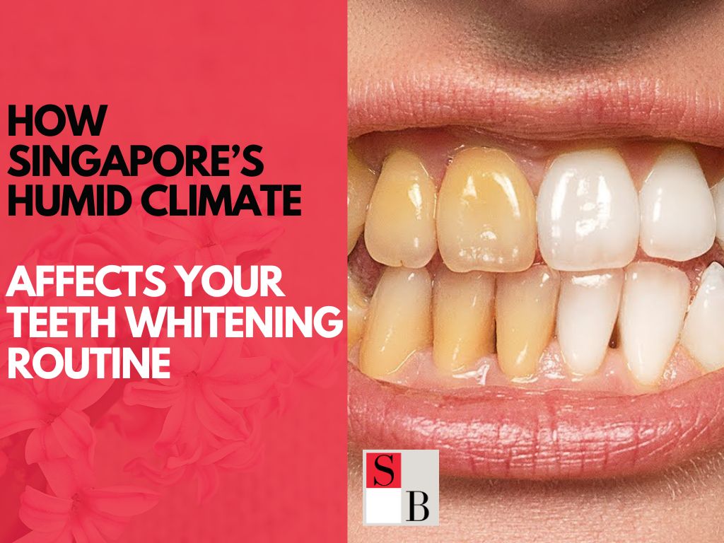 How Singapore’s Humid Climate Affects Your Teeth Whitening Routine