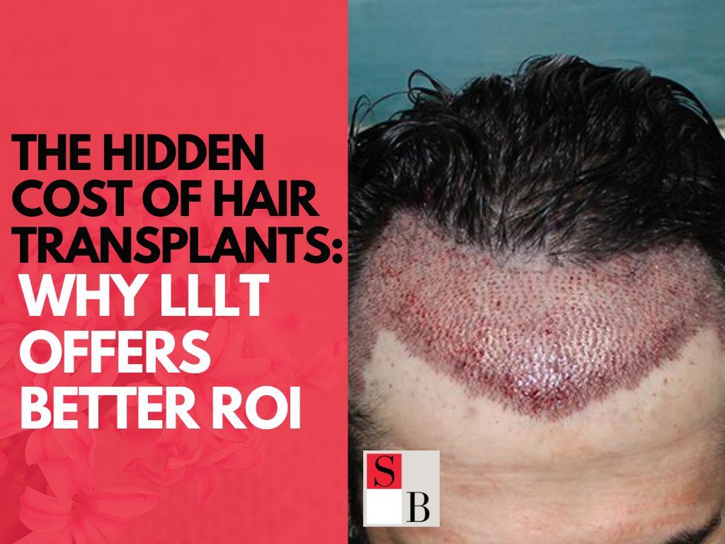 The Hidden Cost of Hair Transplants: Why LLLT Offers Better ROI