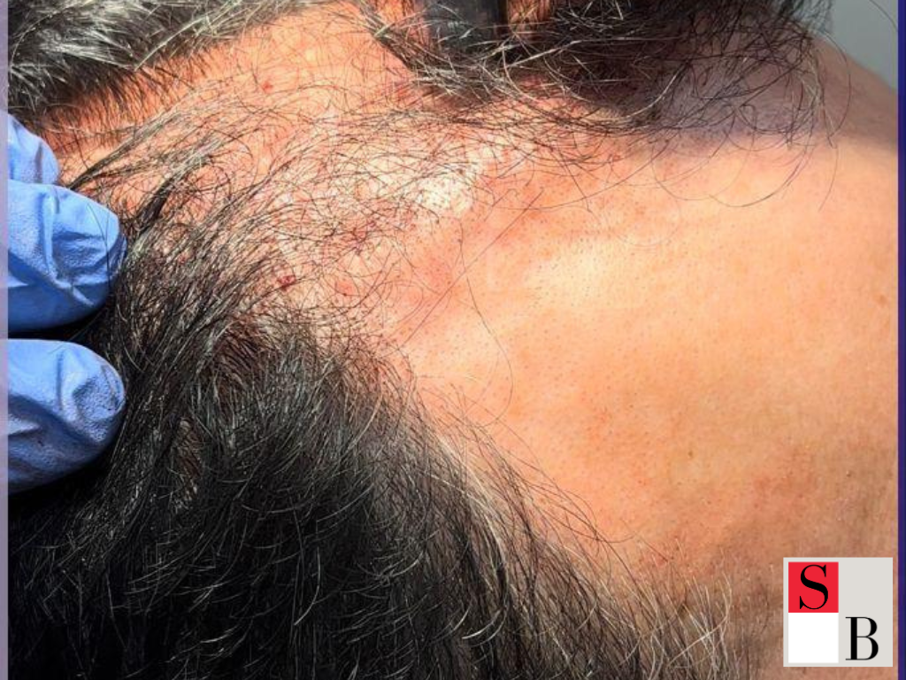 Daily Hair Care Tips for Singapore’s Humid Climate