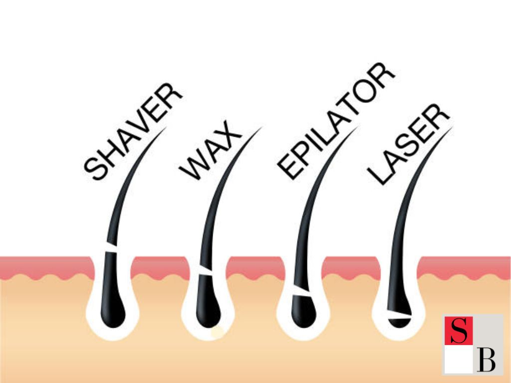 What is SHR Hair Removal and Why It’s Transforming Singapore’s Beauty Routine