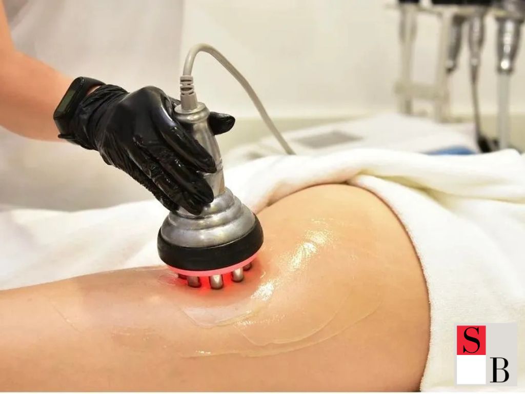 Professional Cellulite Solutions at Wellaholic Upper Changi