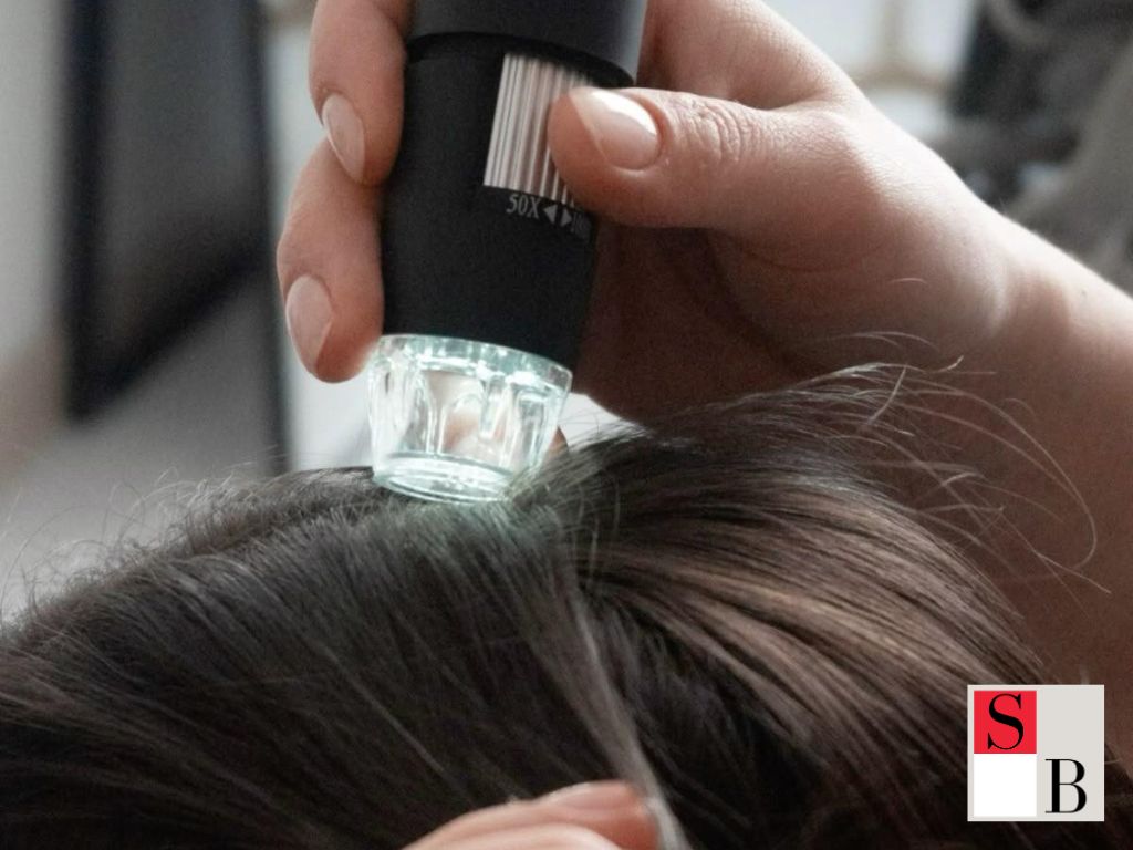 Professional Hair Loss Solutions at Wellaholic