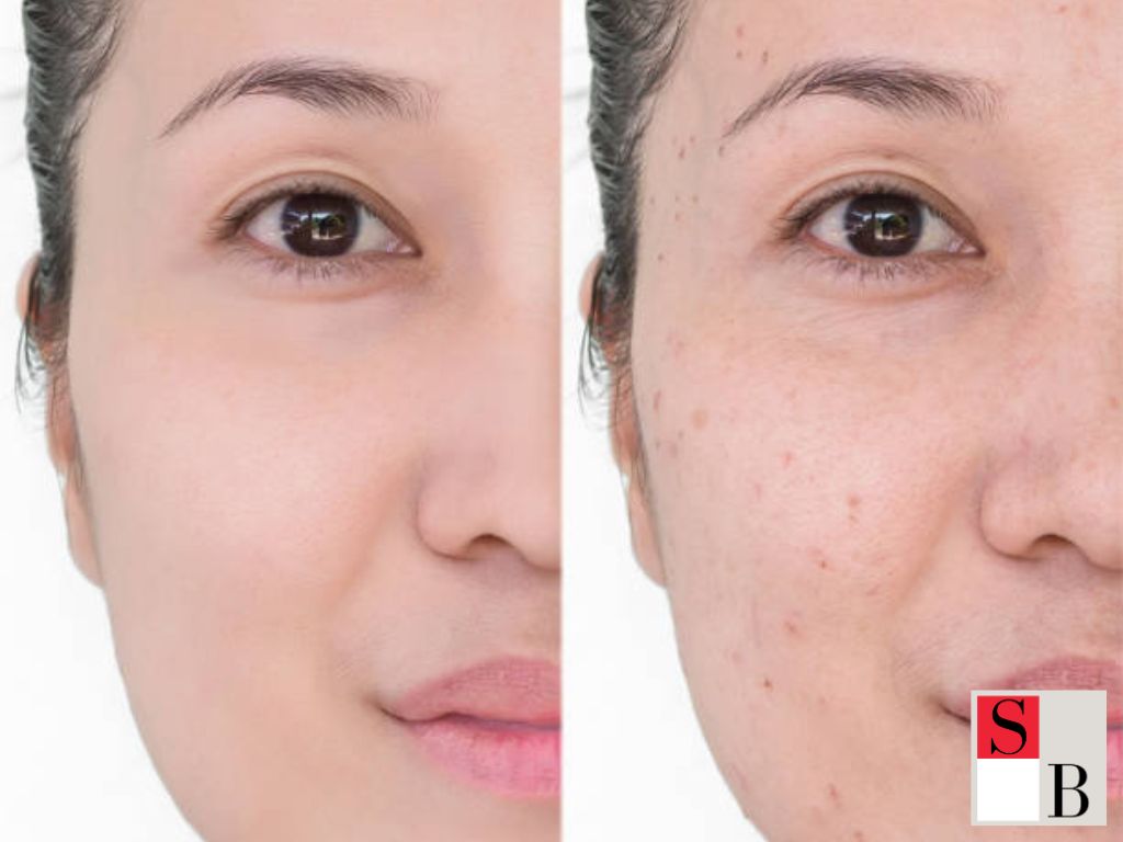 Why Serangoon Beauty Treatments Deliver Premium Results