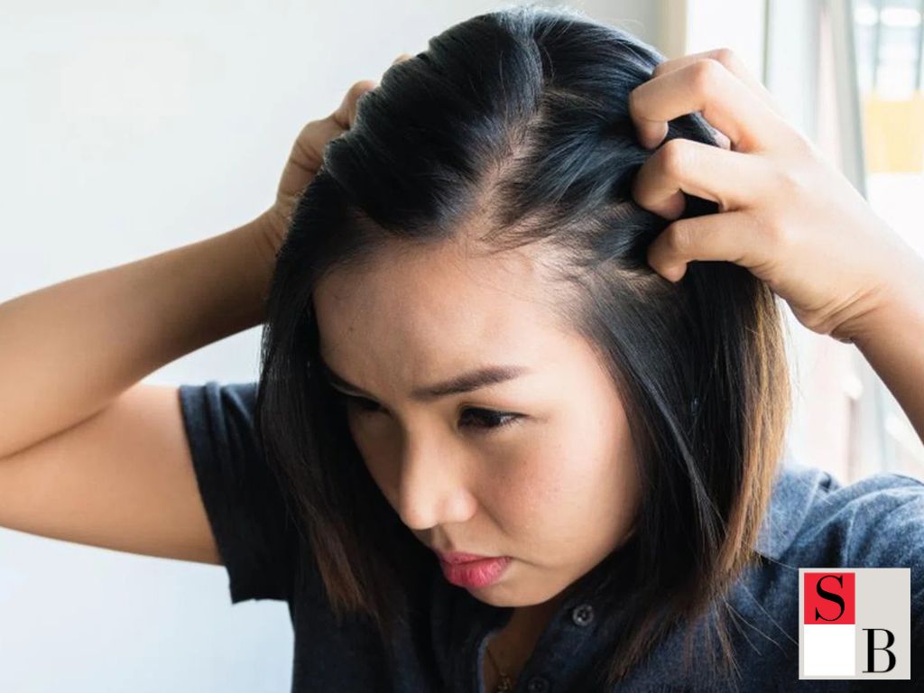 Key Benefits of Targeted Postpartum Hair Regrowth Strategies in Singapore