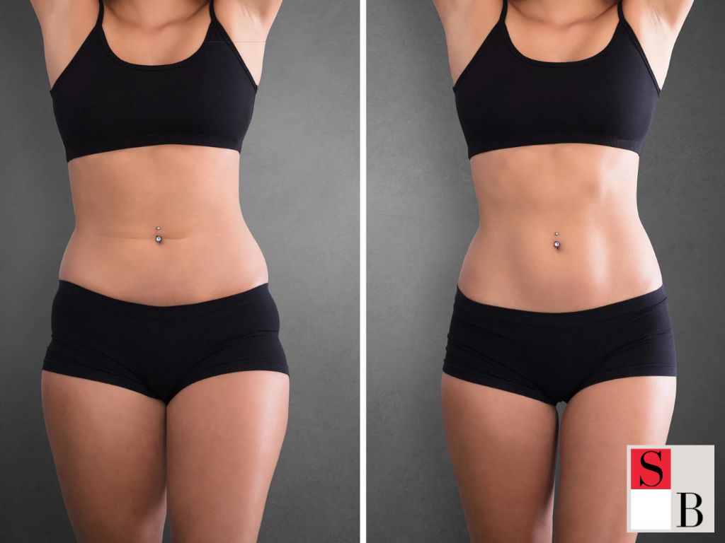 Benefits of the Latest Body Contouring Innovations in Singapore