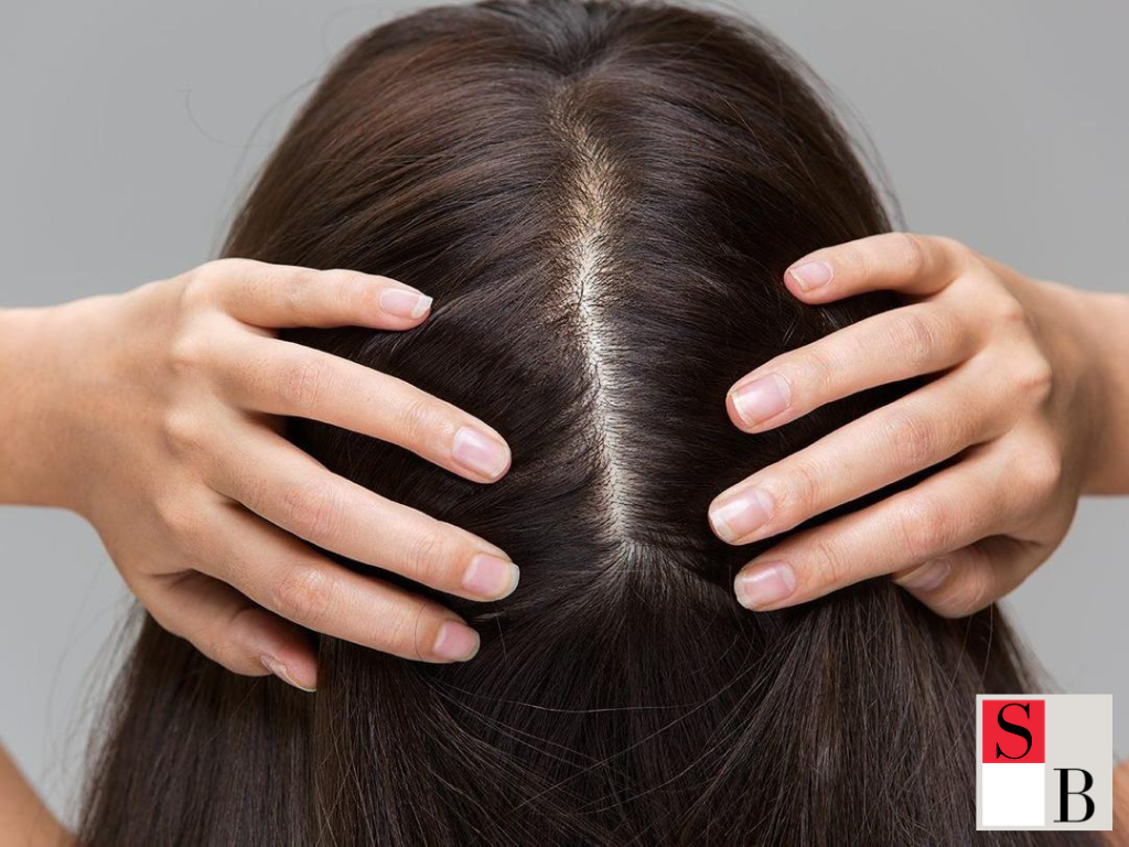 What Really Causes Hair Loss in Singapore’s Climate