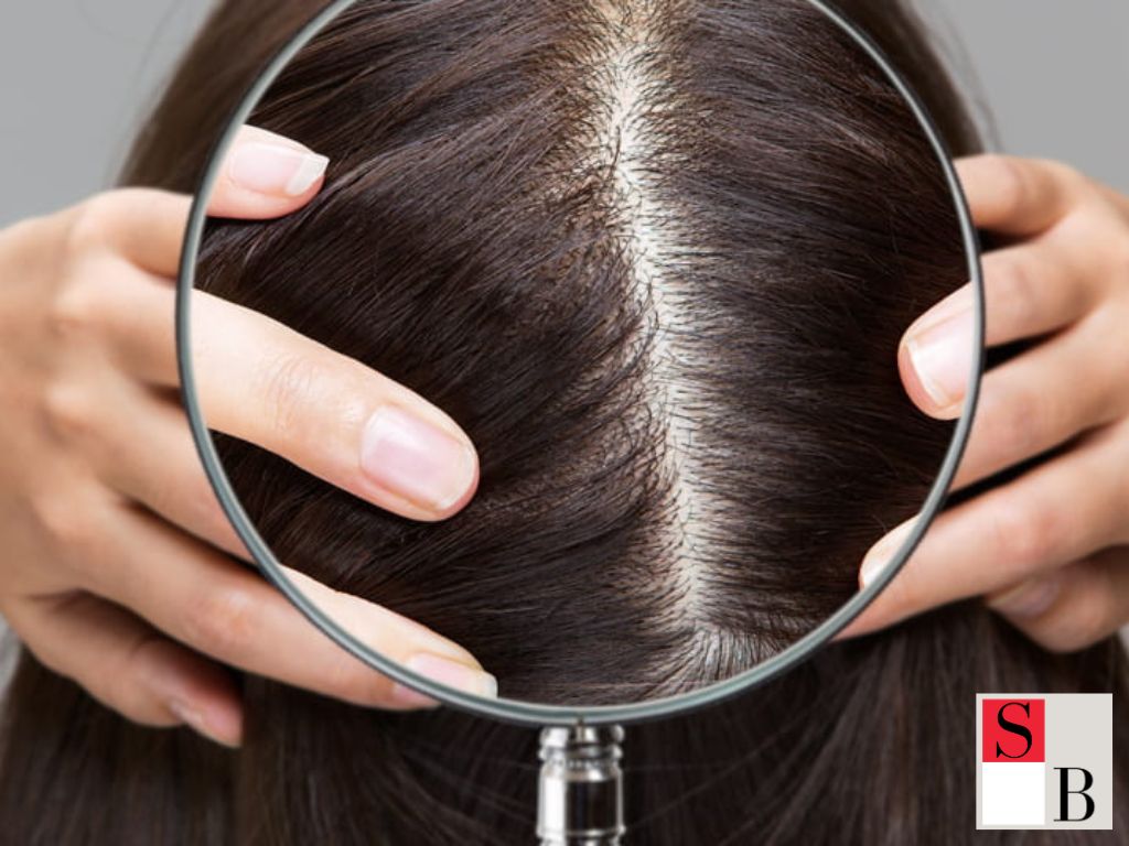 Benefits of Maintaining a Healthy Scalp for Strong Hair