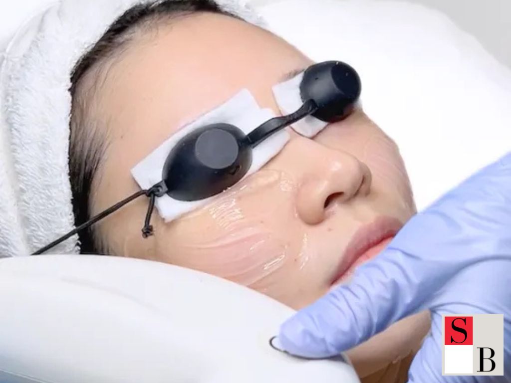 What Is an Elight Facial and Why It’s Perfect for Singapore’s Climate