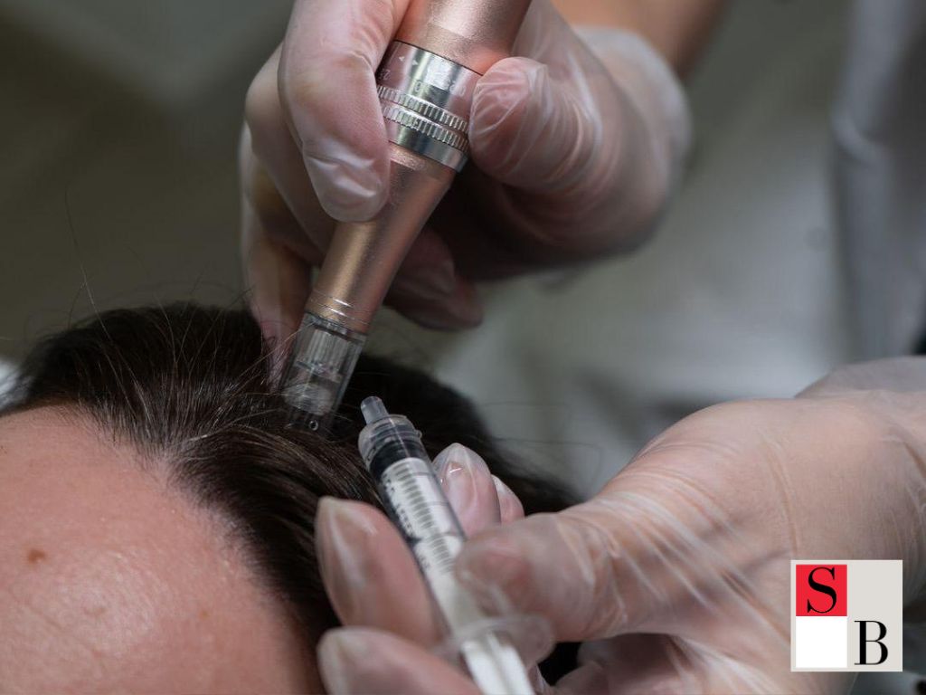 Effective Hair Loss Treatments for Singaporean Women