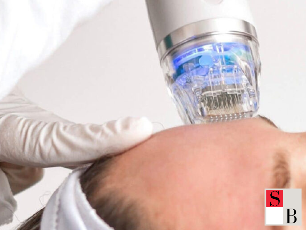 What Is Microneedling and Why Sensitive Skin Needs Special Care