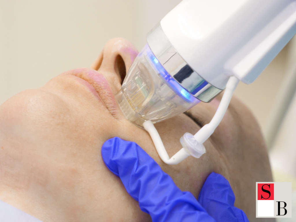 Professional Microneedling Solutions for Sensitive Skin in Singapore