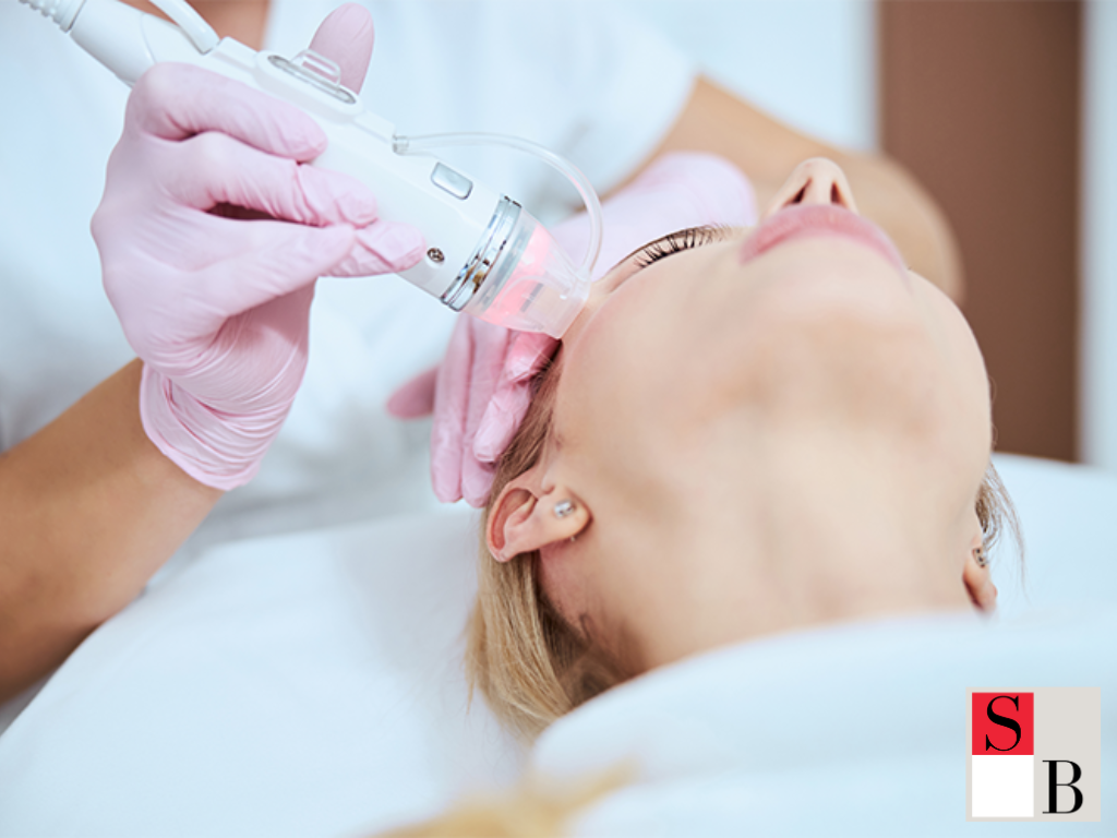 How to Safely Try Microneedling with Sensitive Skin in Singapore