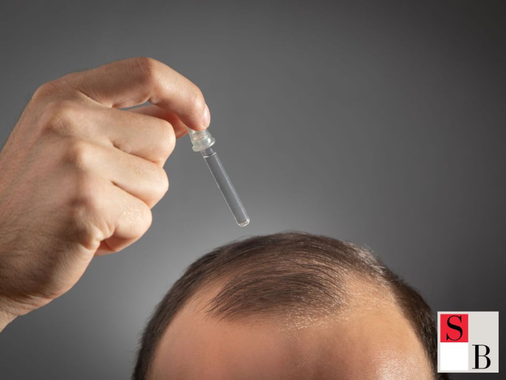 Practical Solutions for Male Pattern Baldness