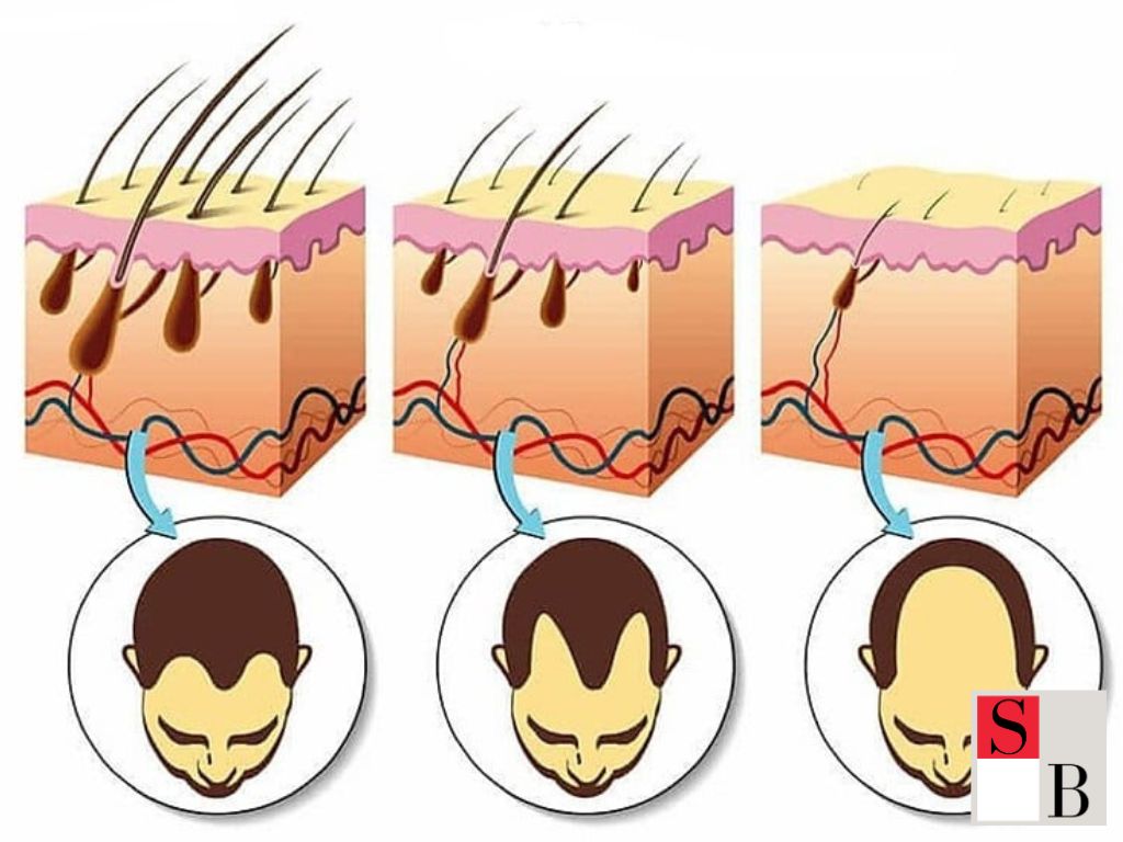 How to Get the Best Results With LLLT in Singapore