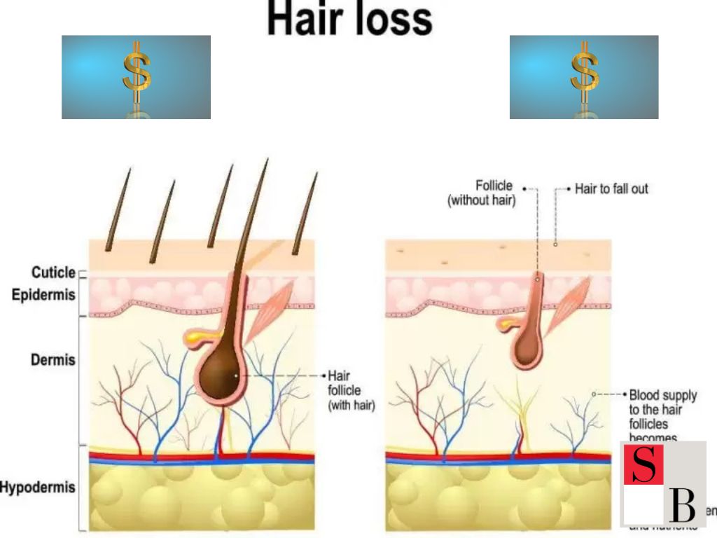 The True Cost of Hair Transplants in Singapore