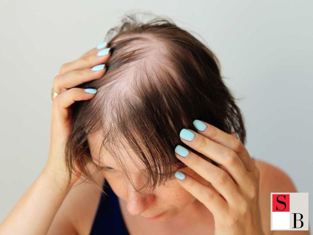 What Causes Hair Loss During Menopause
