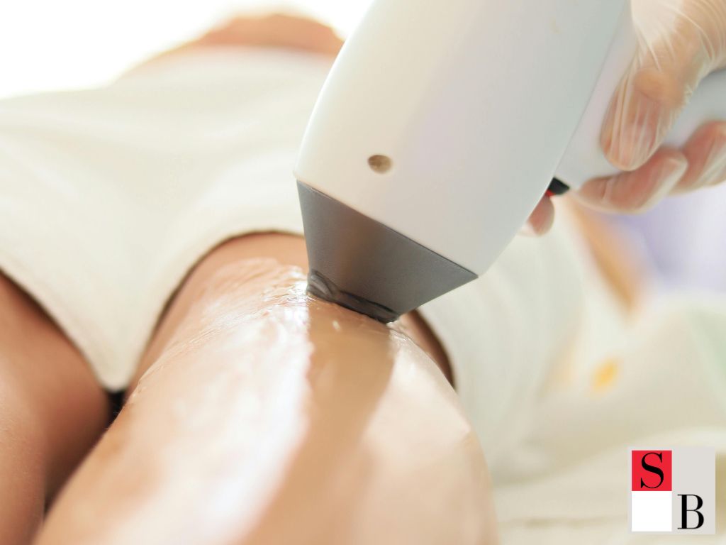 When Should Singapore Athletes Start Hair Removal