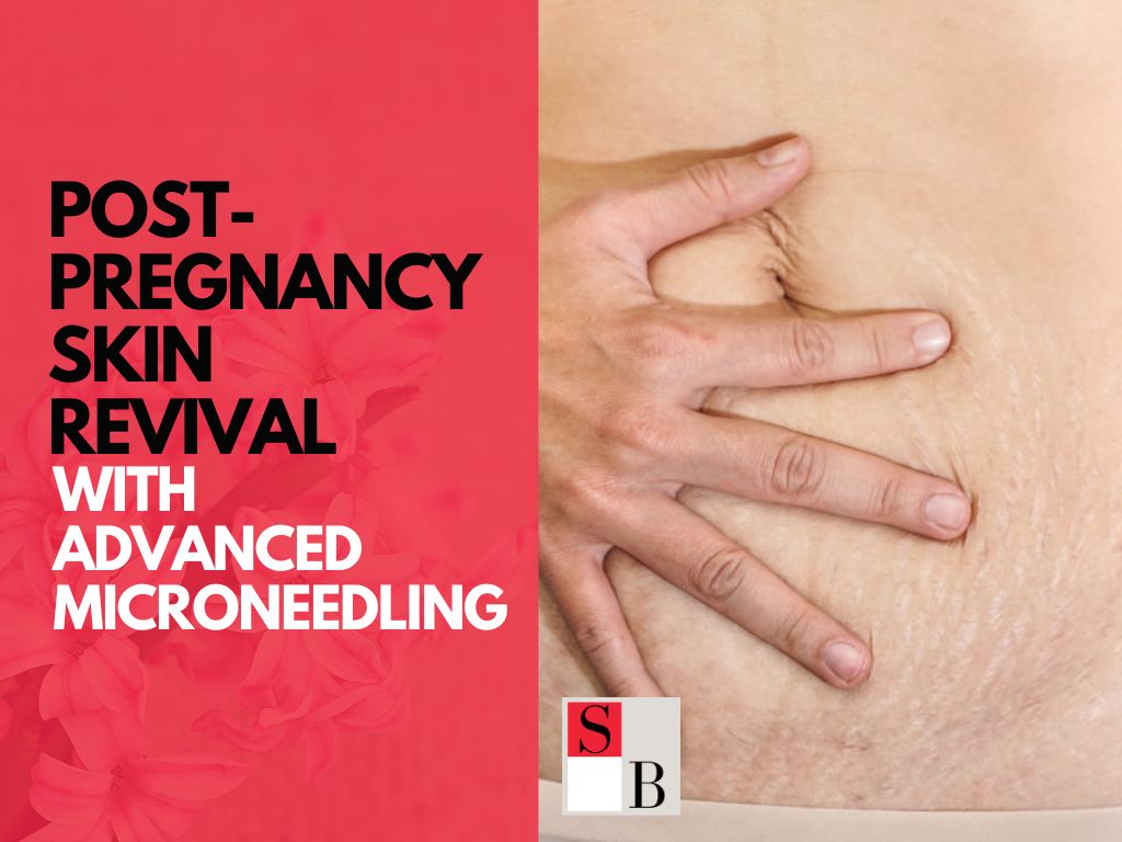 Post-Pregnancy Skin Revival with Advanced Microneedling