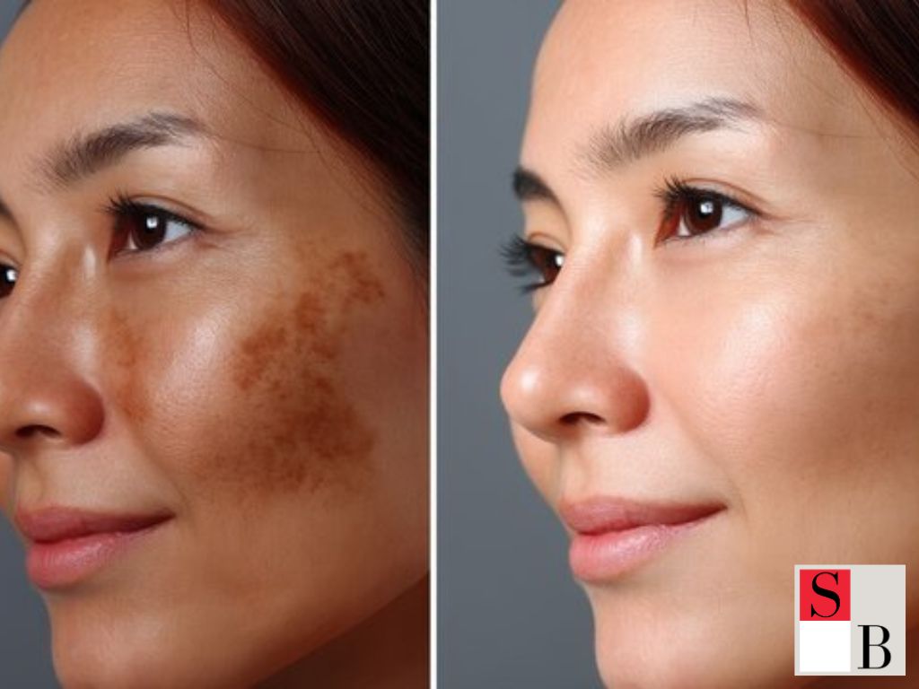 Understanding Student Skin Challenges in Singapore’s Humid Climate