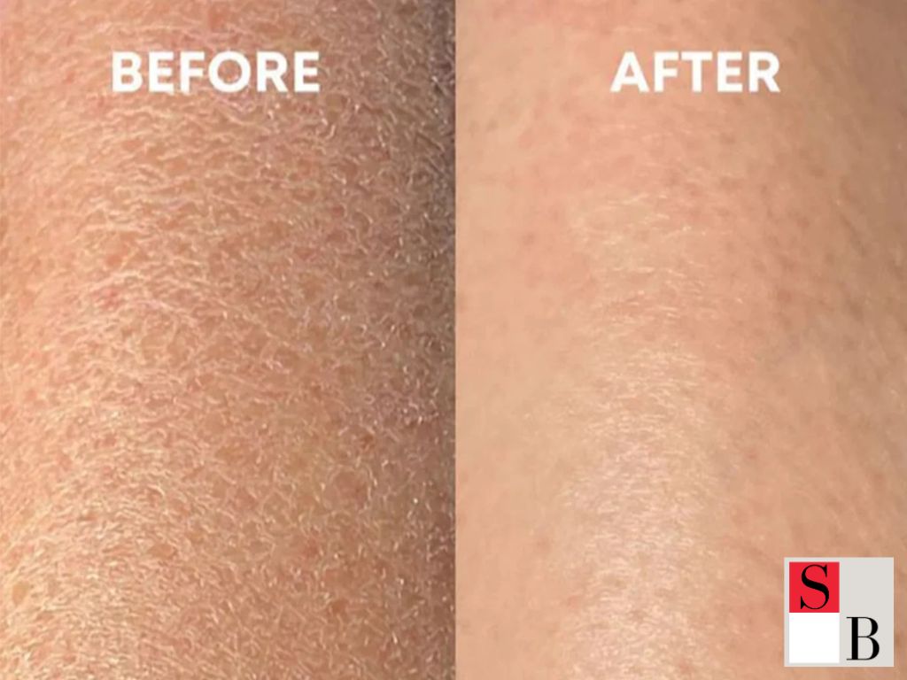 Benefits of Depilatory Creams for Asian Skin