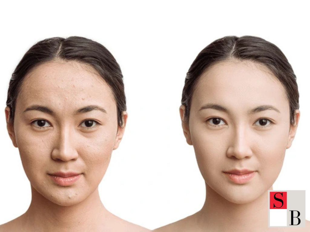 Benefits of Couples Beauty Treatments in Singapore