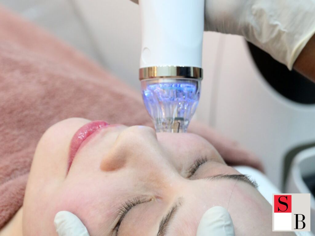 RF Microneedling with Wellaholic Singapore