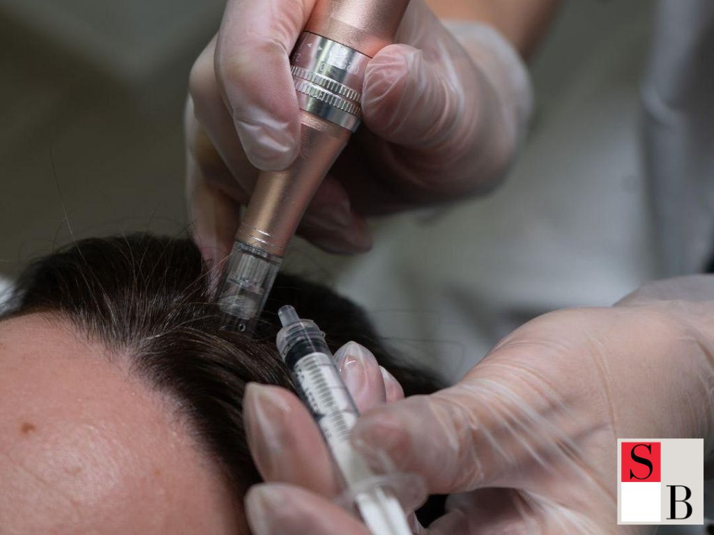 Practical Steps for Effective Hair Regrowth in Singapore