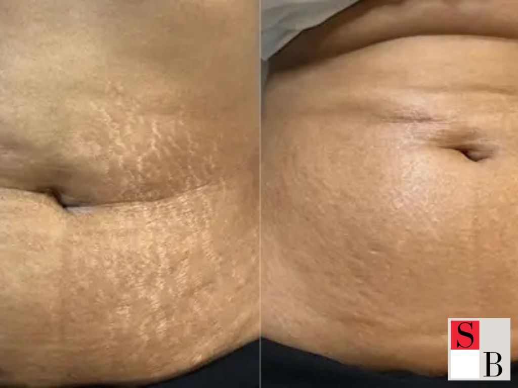 Post-Pregnancy Skin Revival Core Concept